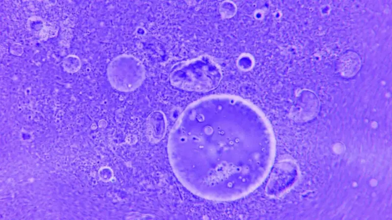 Gli enzimi oceanici non riescono a tagliare il PET cristallino