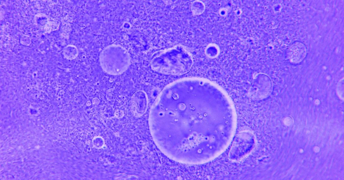 Gli enzimi oceanici non riescono a tagliare il PET cristallino